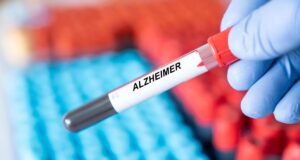 Alzheimer : le sang menstruel pourrait aider à traiter la maladie selon une étude