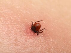 Allergie à la viande : les morsures de tiques peuvent en être la cause