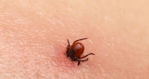 Allergie à la viande : les morsures de tiques peuvent en être la cause