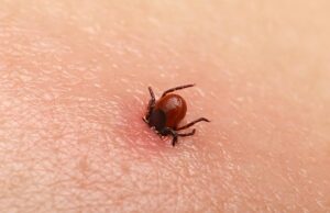 Allergie à la viande : les morsures de tiques peuvent en être la cause