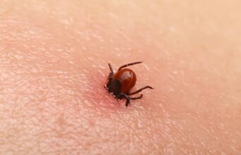 Allergie à la viande : les morsures de tiques peuvent en être la cause