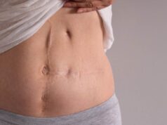 Ablation de l’utérus : les avantages et les inconvénients de l’hystérectomie