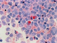 Cancer : un nouveau médicament capable d’éradiquer les tumeurs