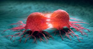 Cancer de la gorge : le sexe oral est le principal facteur de risque
