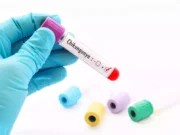 Chikungunya : quels sont les signes à ne pas négliger ?