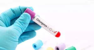 Chikungunya : quels sont les signes à ne pas négliger ?