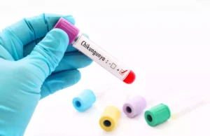 Chikungunya : quels sont les signes à ne pas négliger ?