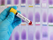 Circulation active du virus West Nile dans un département français