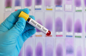 Circulation active du virus West Nile dans un département français