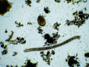 Victime de pertes de mémoire : des médecins retirent un ver de 8cm vivant dans le cerveau d’une australienne