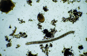 Victime de pertes de mémoire : des médecins retirent un ver de 8cm vivant dans le cerveau d’une australienne