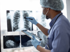 Cancers chez les moins de 50 ans : 80% d’augmentation, selon une étude