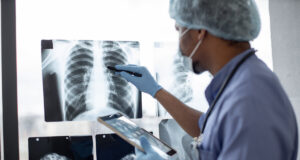 Cancers chez les moins de 50 ans : 80% d’augmentation, selon une étude