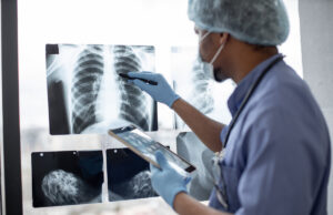 Cancers chez les moins de 50 ans : 80% d’augmentation, selon une étude