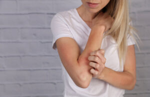 Eczéma : plus de 2 millions de Français concernés