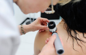 Quand avez-vous vu un dermatologue pour la dernière fois ?