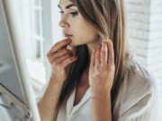 Eczéma : ces aliments à éviter