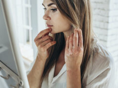 Eczéma : ces aliments à éviter