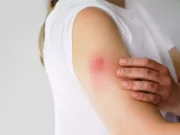 Pourquoi avoir de nombreux symptômes après un vaccin Covid est une bonne chose selon une étude ?