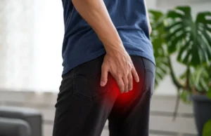 Comment soigner des hémorroïdes externes rapidement ?