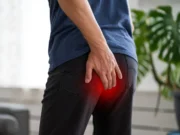 Comment soigner des hémorroïdes externes rapidement ?