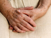 Comment faire disparaître les taches de vieillesse sur la peau ?