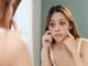 Marre des cernes et des poches sous vos yeux ? Voici comment les enlever