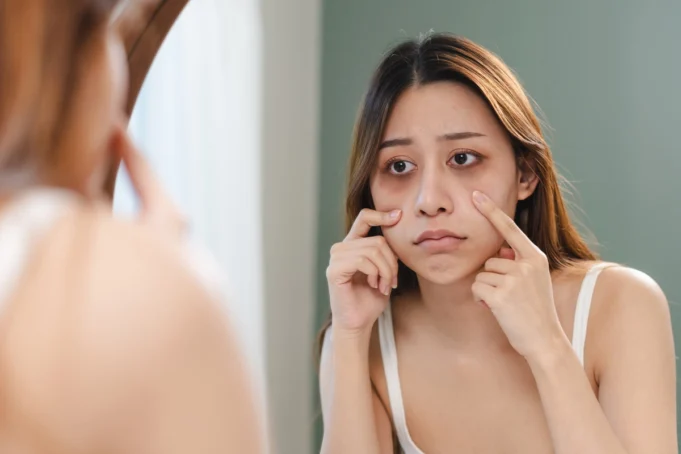 Marre des cernes et des poches sous vos yeux ? Voici comment les enlever