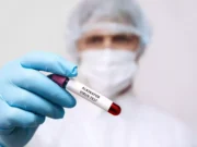 Que sait-on sur ce nouveau virus mortel en Alaska ?