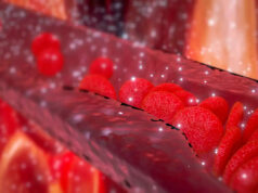 Nos artères remplies de microplastiques, selon une nouvelle étude