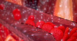 Nos artères remplies de microplastiques, selon une nouvelle étude