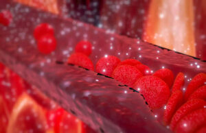 Nos artères remplies de microplastiques, selon une nouvelle étude