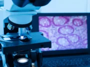 Cancers : «découverte très importante» des chercheurs français