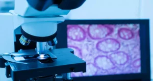 Cancers : «découverte très importante» des chercheurs français