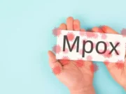 Épidémie de Mpox : faut-il se vacciner si vous partez à l’étranger ?