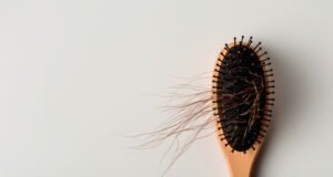 Chute de cheveux : 5 bons réflexes pour freiner la perte capillaire