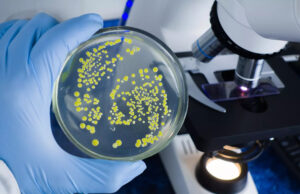 Des chercheurs préviennent : cette bactérie provoque des infarctus mortels, des millions de personnes concernées