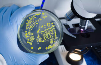 Des chercheurs préviennent : cette bactérie provoque des infarctus mortels, des millions de personnes concernées