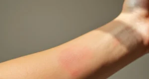 Démangeaisons mystérieuses : quand faut-il s’inquiéter vraiment