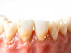 Hygiène dentaire négligée : un danger mortel qu’il faut éviter