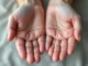 Les Signes inhabituels Au Niveau de vos mains :Des signes révélateurs du cancer du poumon à ne pas ignorer