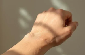 Peau sèche persistante : signes d’une maladie grave à ne pas ignorer