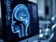Cancer du cerveau : symptômes, risques et ce que vous devez savoir