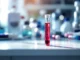 Nouveau test sanguin qui révolutionne la détection du cancer du cerveau