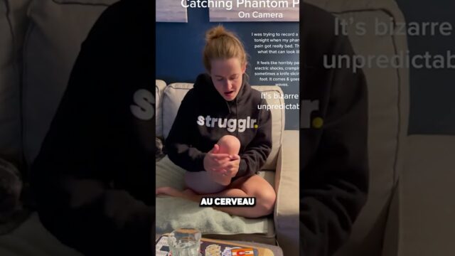 ELLE RESSENT UNE DOULEUR DANS SA JAMBE ABSENTE ! 😱🦵🧠