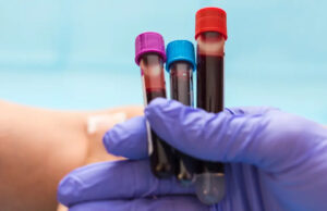 Ce groupe sanguin fait vieillir le cerveau plus vite : 2,7 millions de Français concernés