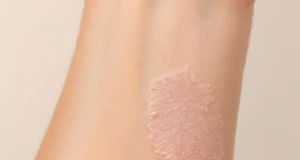 Eczéma atopique : découvrez comment soulager cette peau qui démange sans arrêt