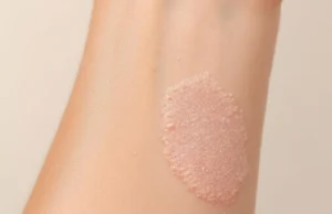 Eczéma atopique : découvrez comment soulager cette peau qui démange sans arrêt