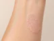 Eczéma atopique : découvrez comment soulager cette peau qui démange sans arrêt