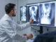 Cancer de la prostate : ce signe qui doit vous pousser à consulter rapidement